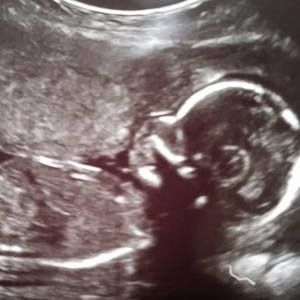 Meet your Posher, Francis